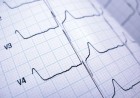 Elettrocardiogramma - Cardiologia Terlizzi